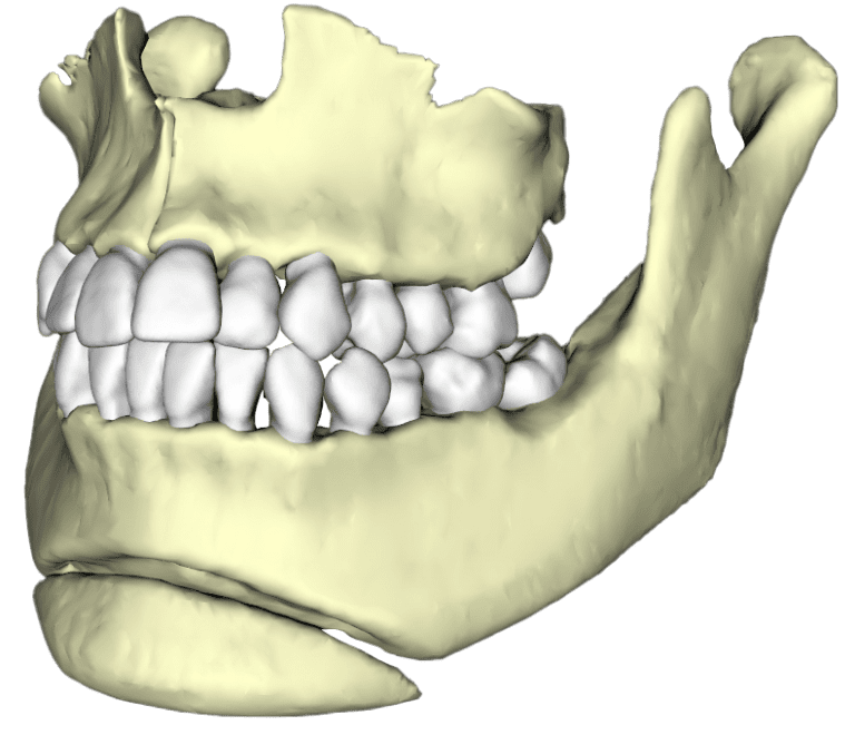 Invivo Model - Osteoid Inc